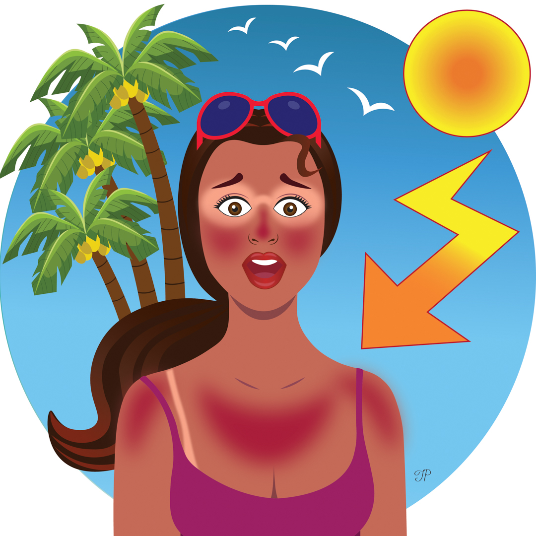Illustration of a very badly sunburnt person in front of palm trees and seagulls, with the sun scorching down from above